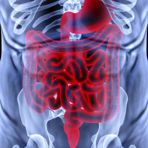 Intestinal Permeability